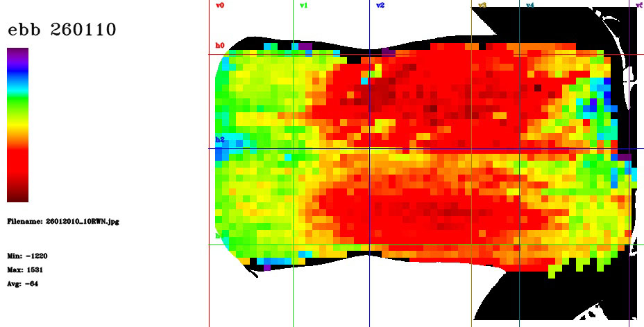 Possible Lung Detection