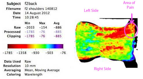 Shoulder Injury Scan
